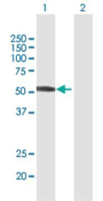 Western Blot: ZNF821 Antibody [H00055565-B01P]