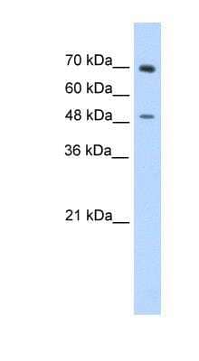 Western Blot: ZNF821 Antibody [NBP1-80335]