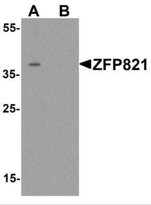 Western Blot: ZNF821 AntibodyBSA Free [NBP2-82055]