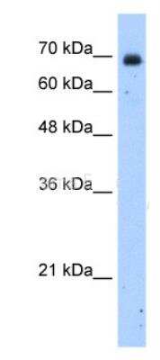 Western Blot: ZNF823 Antibody [NBP1-91372]