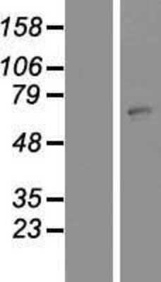 Western Blot: ZNF823 Overexpression Lysate [NBP2-08396]