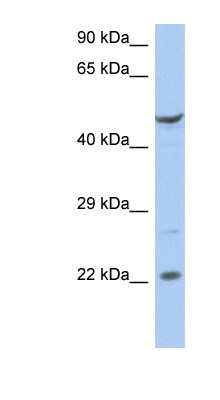 Western Blot: ZNF826P Antibody [NBP1-91369]