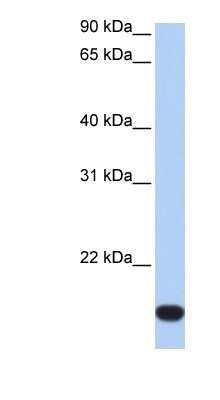 Western Blot: ZNF826P Antibody [NBP1-91370]