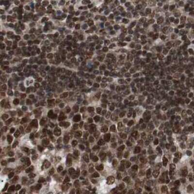 Immunohistochemistry-Paraffin: ZNF828 Antibody [NBP1-88402]