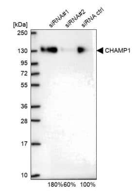 Western Blot: ZNF828 Antibody [NBP1-88402]