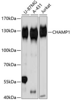 Western Blot: ZNF828 AntibodyAzide and BSA Free [NBP2-93670]