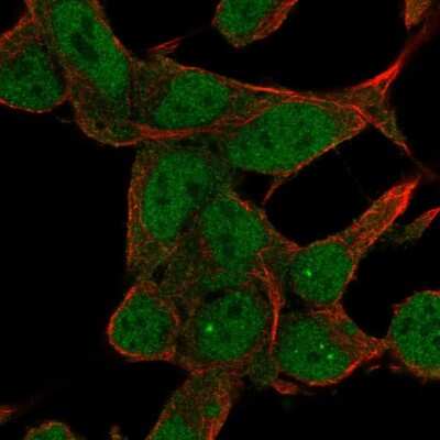 Immunocytochemistry/ Immunofluorescence: ZNF829 Antibody [NBP2-57673]