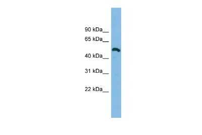 Western Blot: ZNF829 Antibody [NBP2-83913]