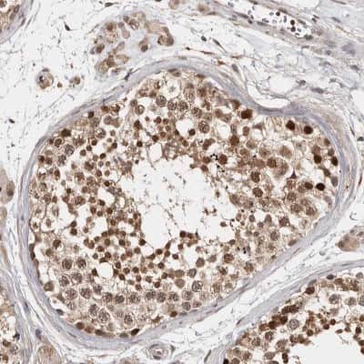 Immunohistochemistry-Paraffin: ZNF83 Antibody [NBP1-83789]