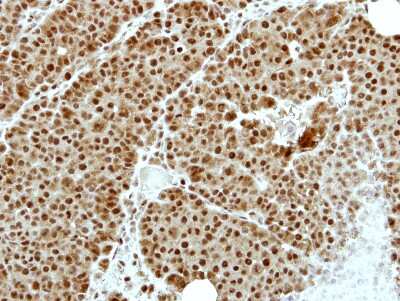 Immunohistochemistry-Paraffin: ZNF83 Antibody [NBP2-21050]
