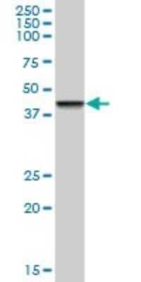 Western Blot: ZNF83 Antibody [H00055769-B01P]