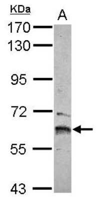 Western Blot: ZNF83 Antibody [NBP2-21049]