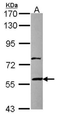 Western Blot: ZNF83 Antibody [NBP2-21050]