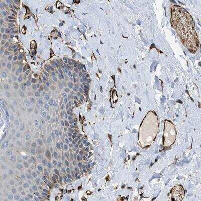 Immunohistochemistry-Paraffin: ZNF831 Antibody [NBP1-90696]