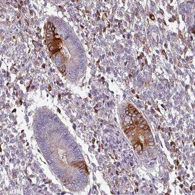Immunohistochemistry-Paraffin: ZNF835 Antibody [NBP2-13600]