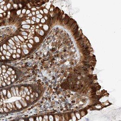 Immunohistochemistry-Paraffin: ZNF84 Antibody [NBP1-81715]