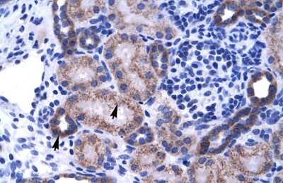 Western Blot: ZNF84 Antibody [NBP2-83914]