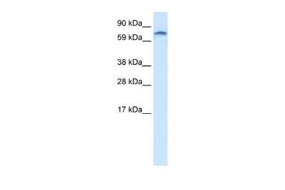 Western Blot: ZNF84 Antibody [NBP2-83914]
