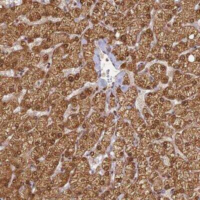 Immunohistochemistry: ZNF443 Antibody [NBP2-46657]