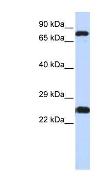 Western Blot: ZNF842 Antibody [NBP1-80201]