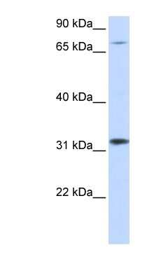 Western Blot: ZNF842 Antibody [NBP1-80202]