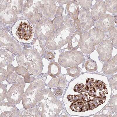 Immunohistochemistry: ZNF843 Antibody [NBP2-48599]