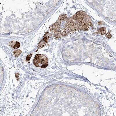 Immunohistochemistry-Paraffin: ZNF843 Antibody [NBP1-93468]