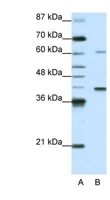 Western Blot: ZNF843 Antibody [NBP1-91549]