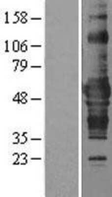 Western Blot: ZNF843 Overexpression Lysate [NBP2-09615]