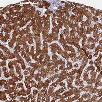 Immunohistochemistry-Paraffin: ZNF844 Antibody [NBP1-94002]