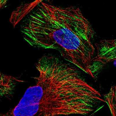 Immunocytochemistry/ Immunofluorescence: ZNF846 Antibody [NBP2-37874]