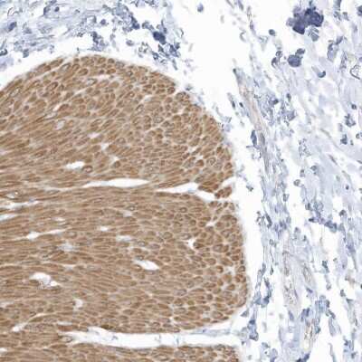 Immunohistochemistry: ZNF846 Antibody [NBP2-37874]