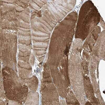 Immunohistochemistry-Paraffin: ZNF846 Antibody [NBP1-90914]