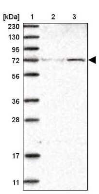 Western Blot: ZNF846 Antibody [NBP1-90914]