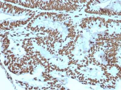 Immunohistochemistry-Paraffin: ZNF846 Antibody (ZNF846/2687) [NBP3-07853]