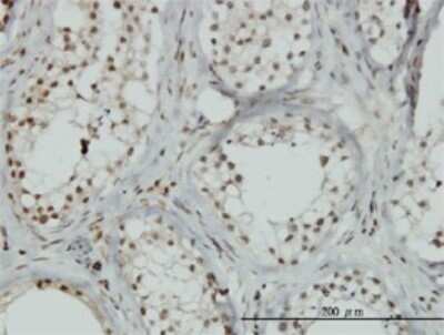 Immunohistochemistry-Paraffin: ZNF85 Antibody (2G9) [H00007639-M02]