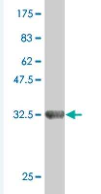 Western Blot: ZNF85 Antibody (4D12) [H00007639-M04]