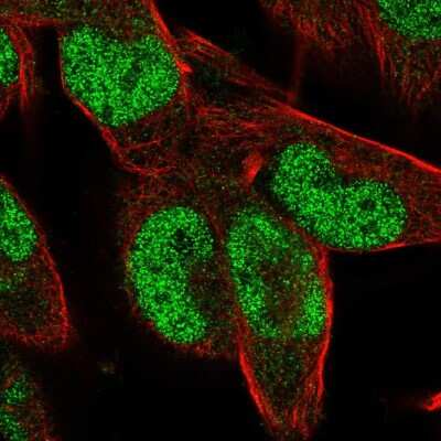 Immunocytochemistry/ Immunofluorescence: ZNF85 Antibody [NBP1-92645]