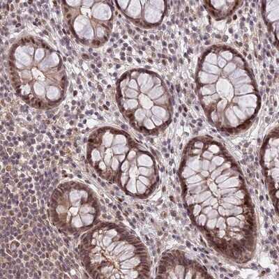 Immunohistochemistry-Paraffin: ZNF85 Antibody [NBP1-92645]