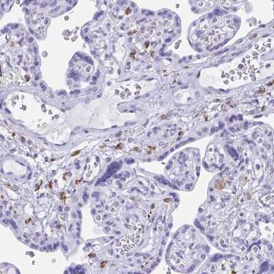Immunohistochemistry-Paraffin: ZNF850 Antibody [NBP2-34185]