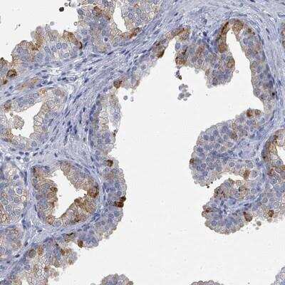 Immunohistochemistry-Paraffin: ZNF852 Antibody [NBP2-13601]