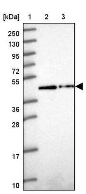 Western Blot: ZNF852 Antibody [NBP2-14804]