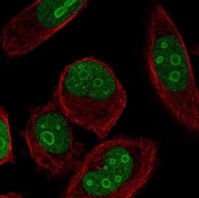 Immunocytochemistry/ Immunofluorescence: ZNF860 Antibody [NBP2-38026]