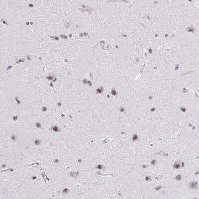 Immunohistochemistry: ZNF860 Antibody [NBP2-38026]