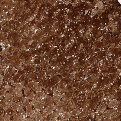 Immunohistochemistry-Paraffin: ZNF862 Antibody [NBP1-91062]