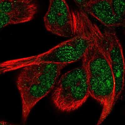 Immunocytochemistry/ Immunofluorescence: ZNF878 Antibody [NBP2-14770]