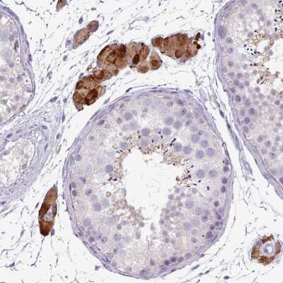 Immunohistochemistry-Paraffin: ZNF878 Antibody [NBP2-14770]