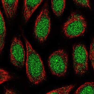 Immunocytochemistry/ Immunofluorescence: ZNF879 Antibody [NBP2-49559]