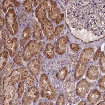 Immunohistochemistry: ZNF879 Antibody [NBP2-49559]