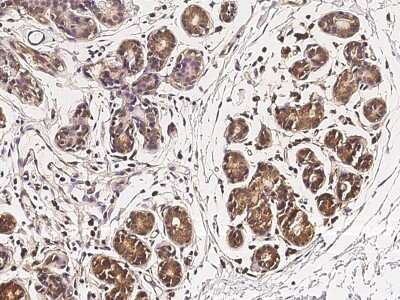 Immunohistochemistry-Paraffin: ZNF879 Antibody [NBP2-98028]